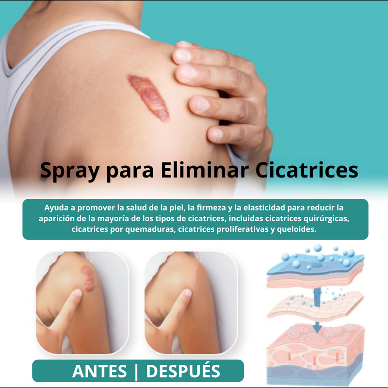 Eliminador de cicatrices ScarErase Spray PAGA 1 Y LLEVA 2