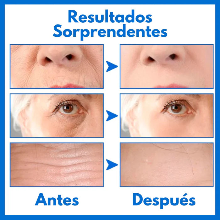 Botox Stock Solution suero antiarrugas - Paga 1 Y Lleva 2