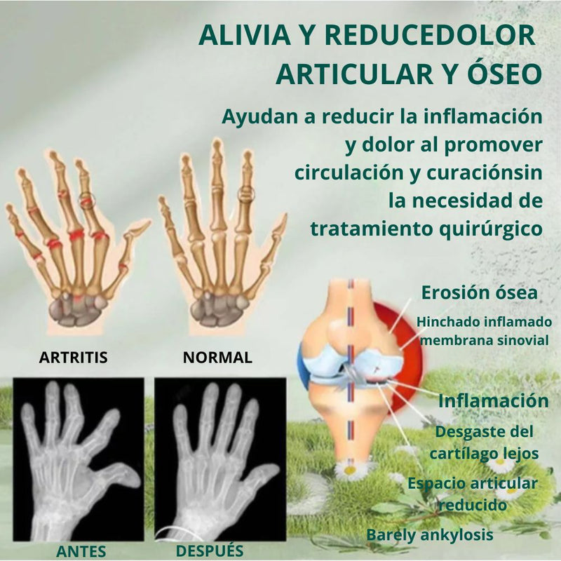 🐝 Beevana™ - Alivia el Dolor Articular y Repara las Articulaciones 🦴 ¡Compra 1 y Llévate 2! 🛒